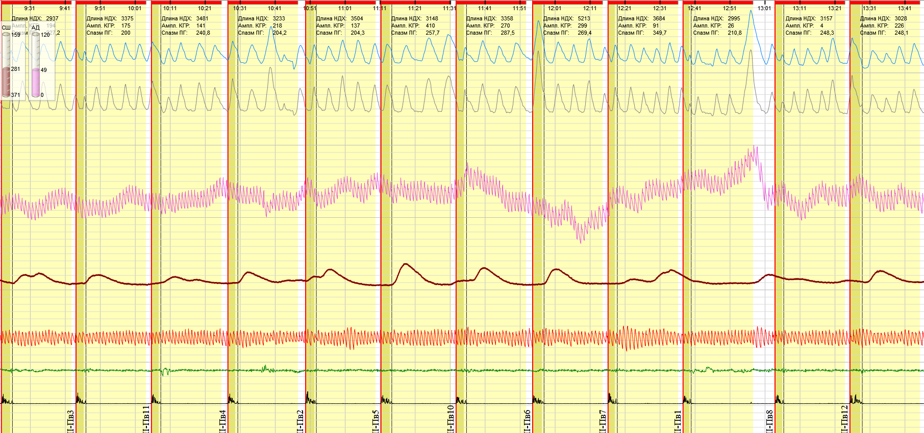 Поисковый ряд 3 повтор 1